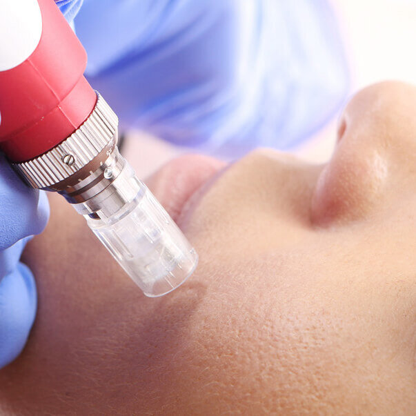 Vedette Beauty and Skincare Brooklyn Microneedling.jpg