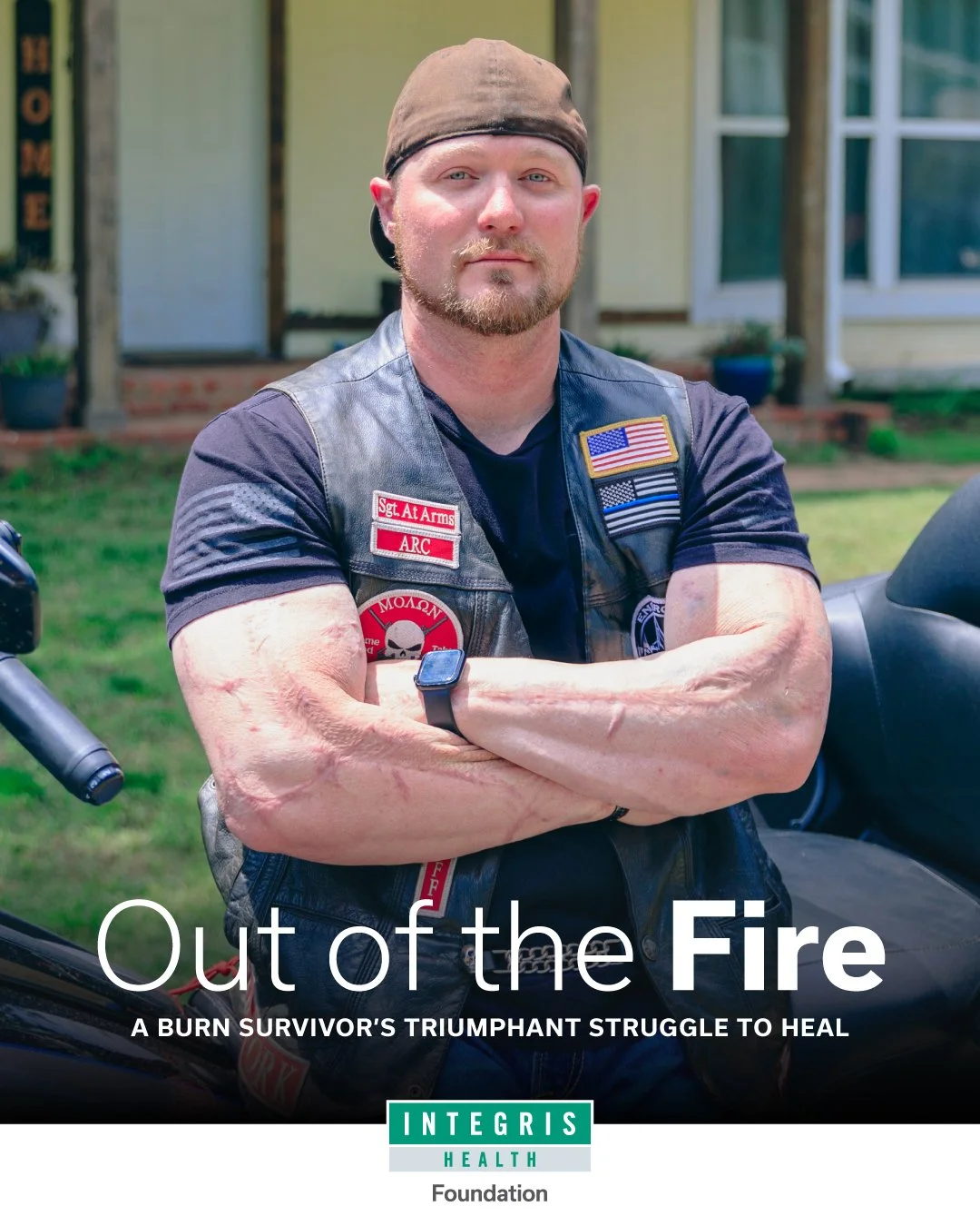 A male burn survivor with scars on his arms, wearing a leather vest with patches, including American flag and law enforcement patches, standing outdoors in front of a house with crossed arms and a serious expression.
