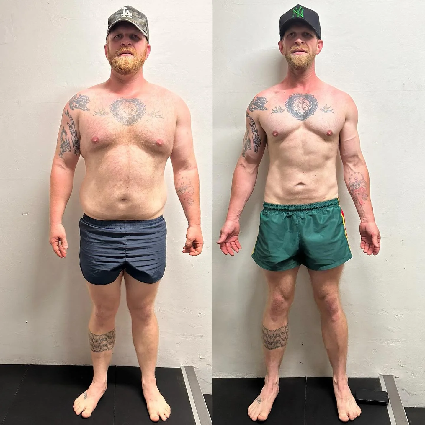 ๐ฅ Great work Alec!
Since his last update at 25 kg down, he’s now dropped a total of 30 kg, come off blood pressure meds, and trimmed his waist by 35 cm — all in 18 months.
The result of consistent training, smart nutrition, and doing t