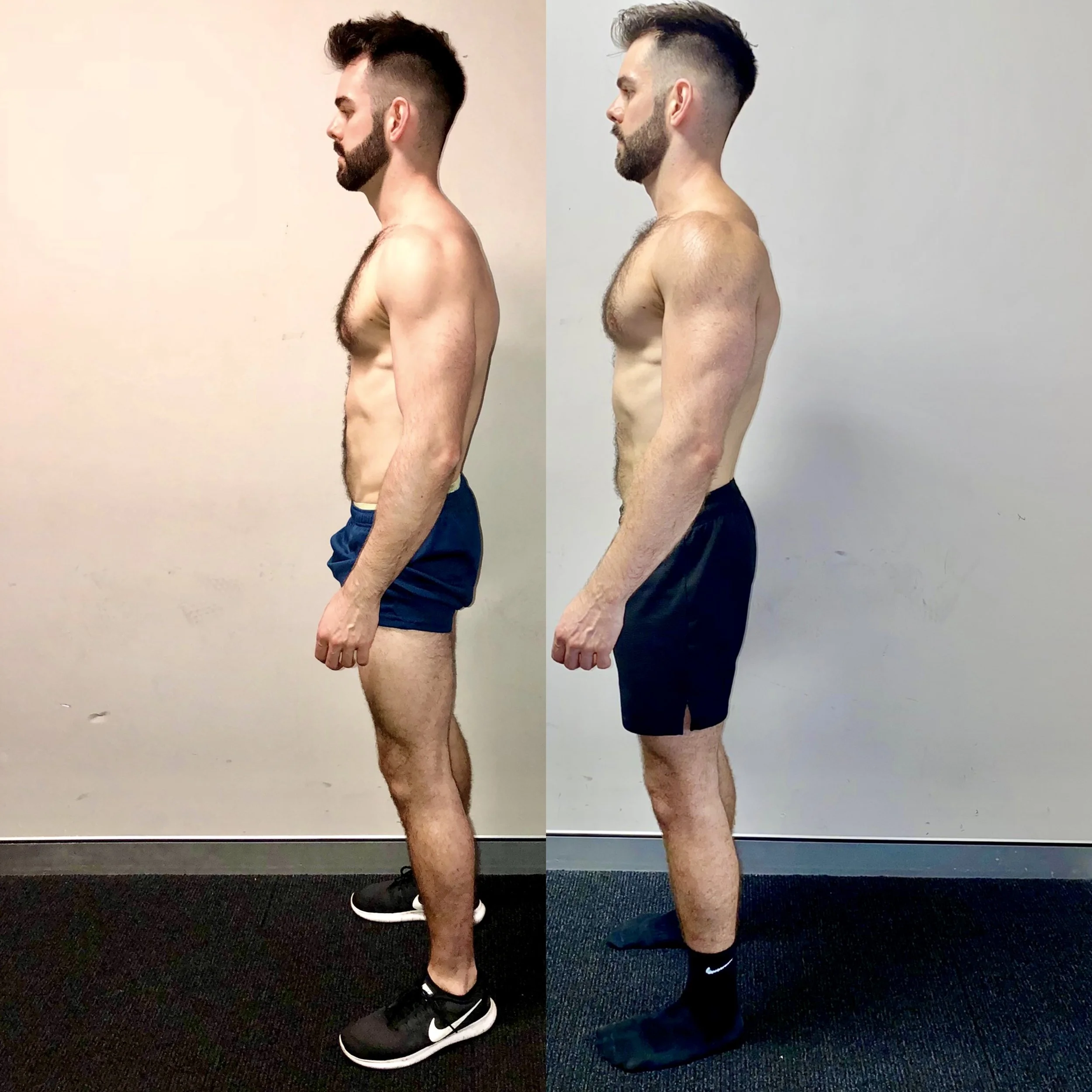posture-correction-transformation-fullform-13.jpg