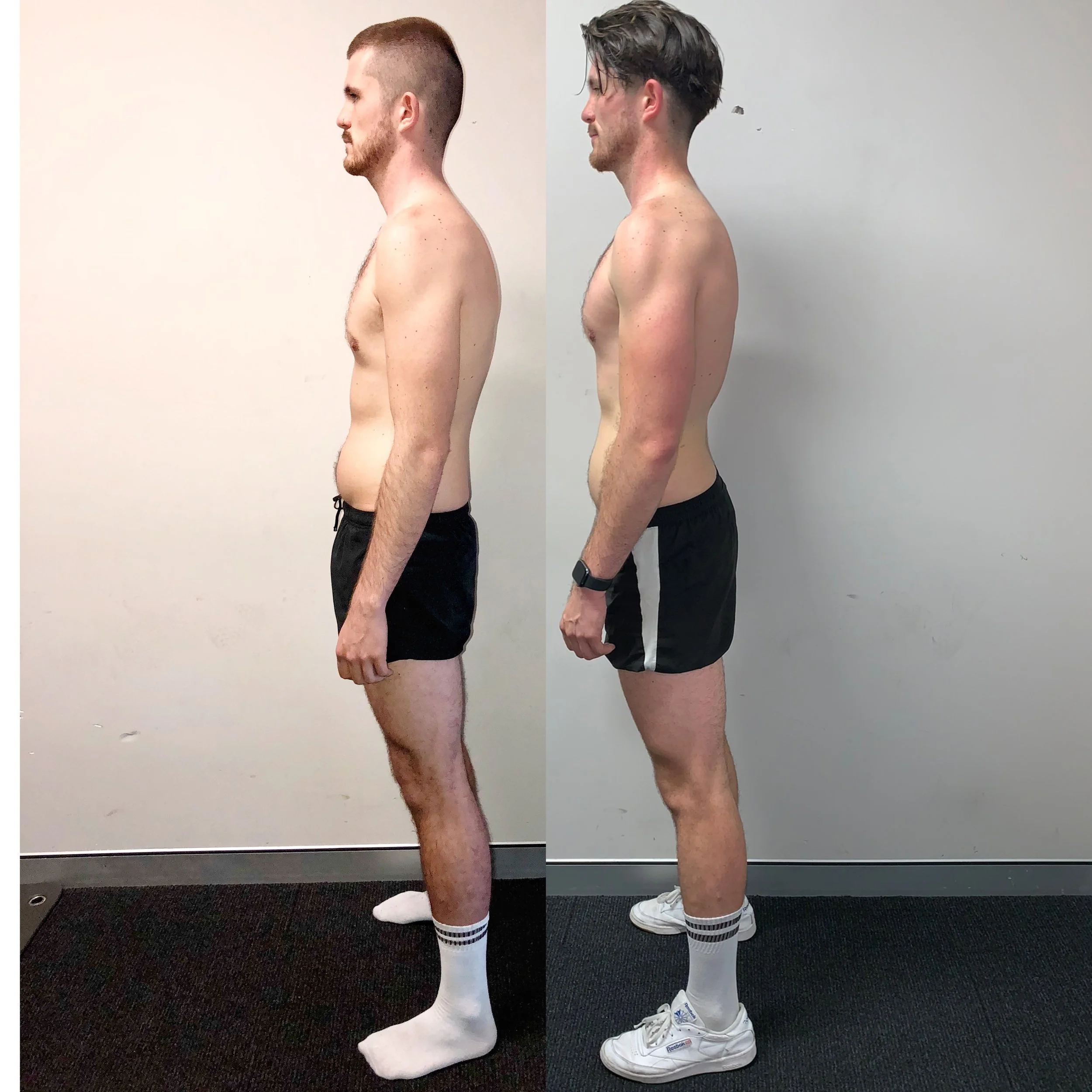posture-correction-before-after-fullform-01.JPG