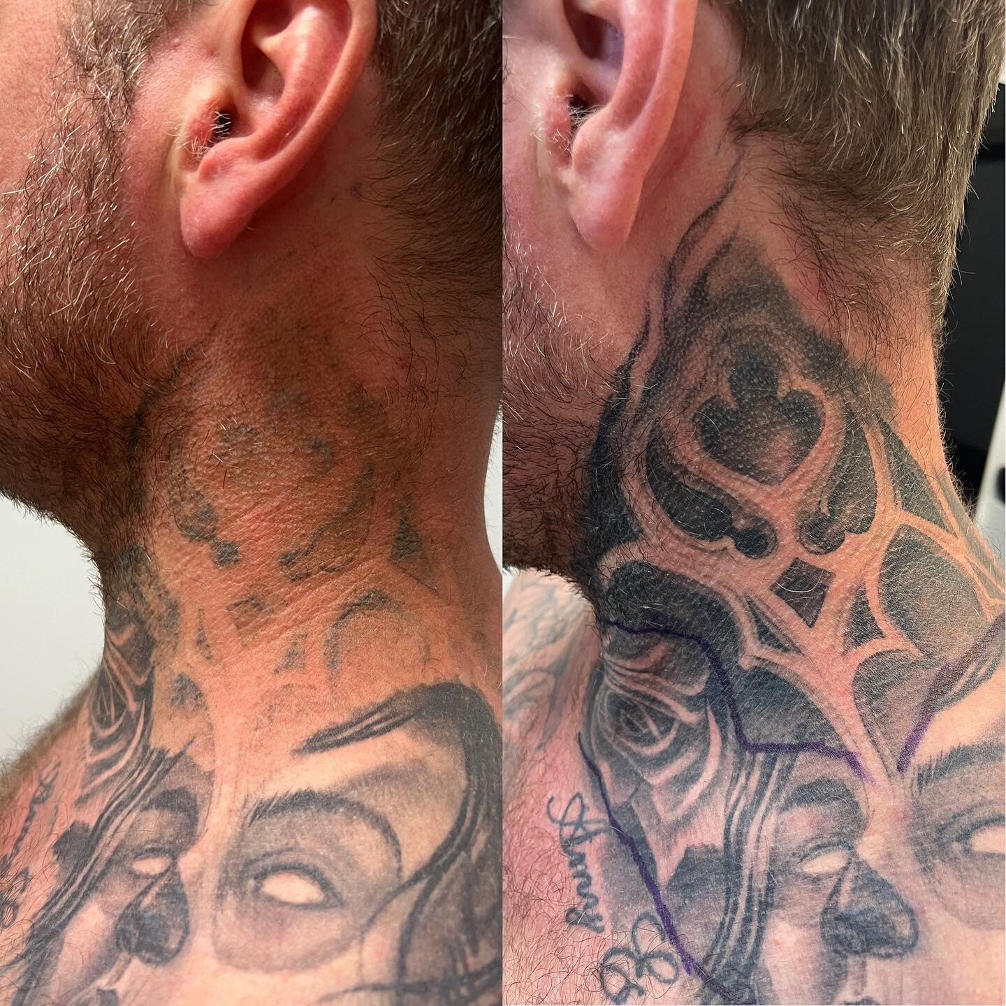 Got a tattoo you need touched up or just want to knock out some ink to lay down some new designs? Jump online and book a free consultation so we can discuss your options. 
.
This tattoo required 2 session to lighten to this effect.
.
.
.
.
.
📞 07 54
