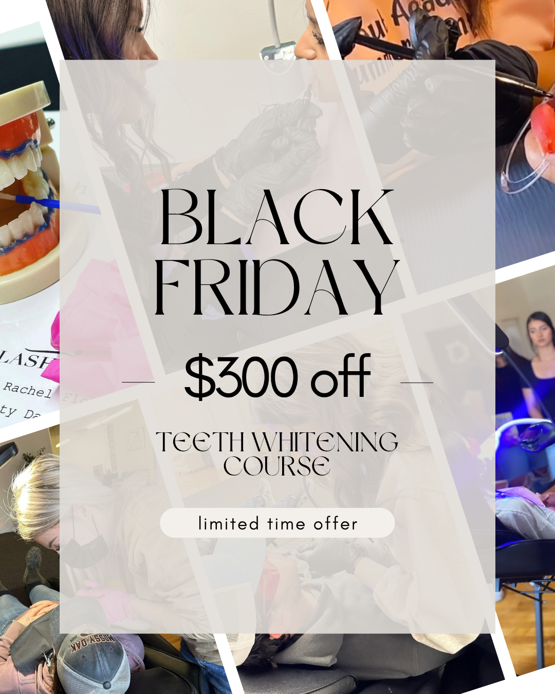 Teeth Whitening Course Deposit