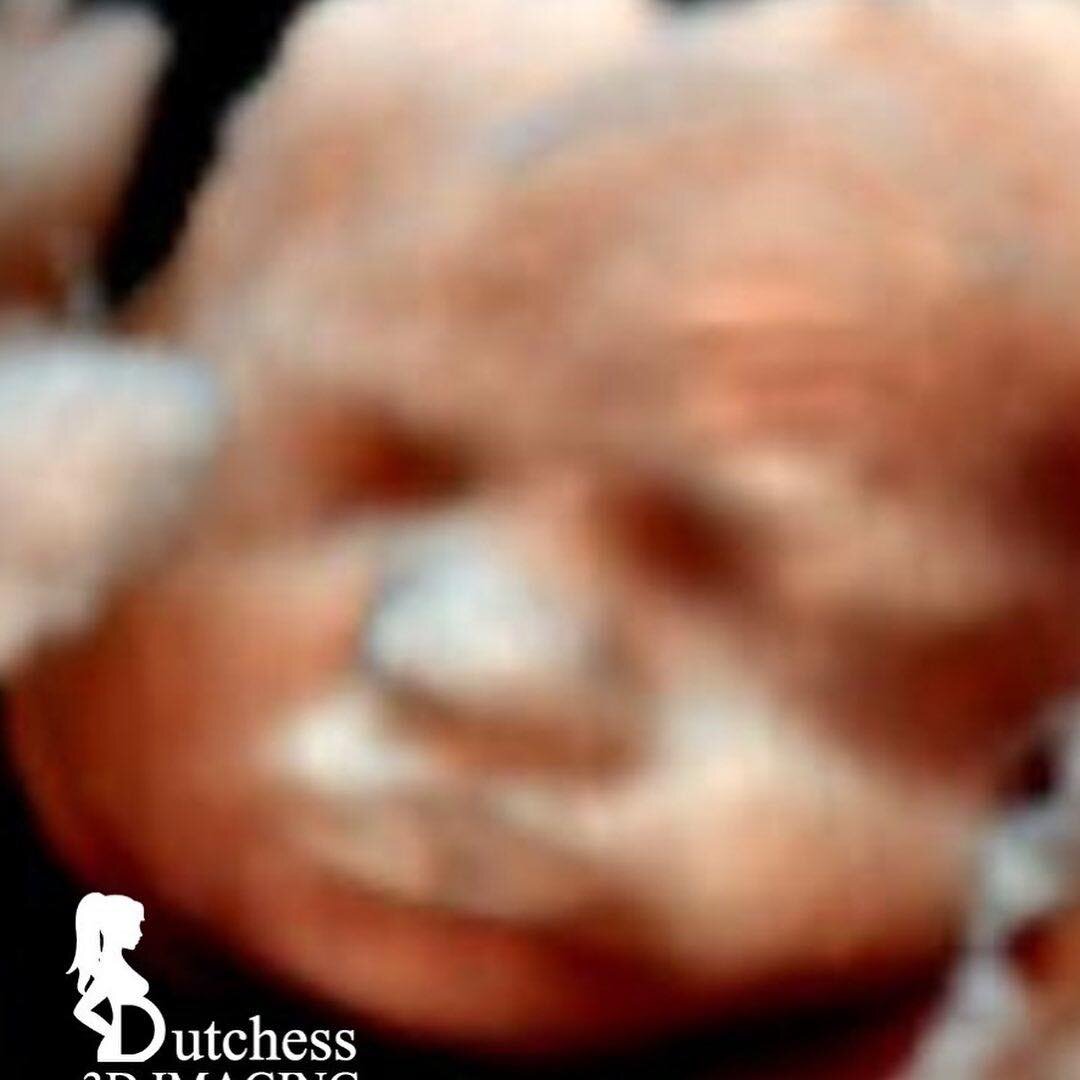 Real View ⭐️

Take advantage of our Enhanced view imaging option on your best 3D or 5D image. 

Only $24.99

#poughkeepsie #dutchess3dimaging #dutchess3D #3rdtrimester #2ndtrimester❤️ #4dultrasound #3rdtrimesterofpregnancy #5dultrasound #28weekspregn