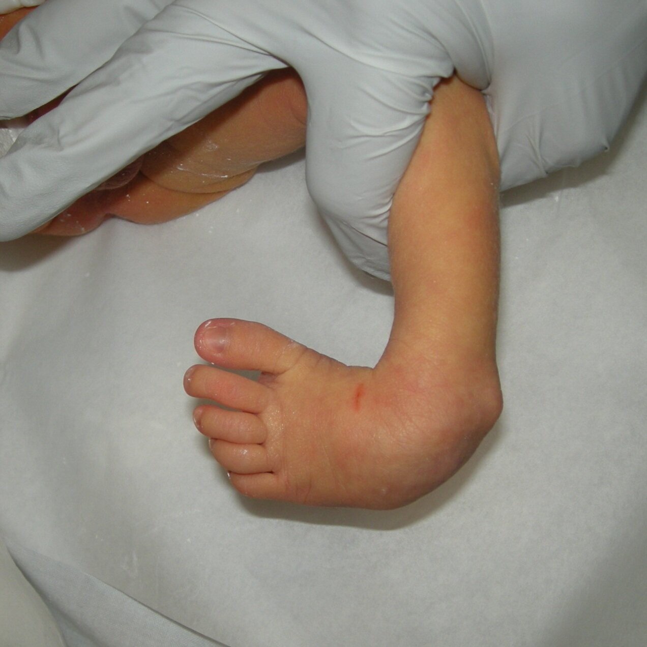 Dr Michael Uglow Is A Leading Expert Foot Ankle Surgeon Specialising In Children S Foot Disorders Untitled