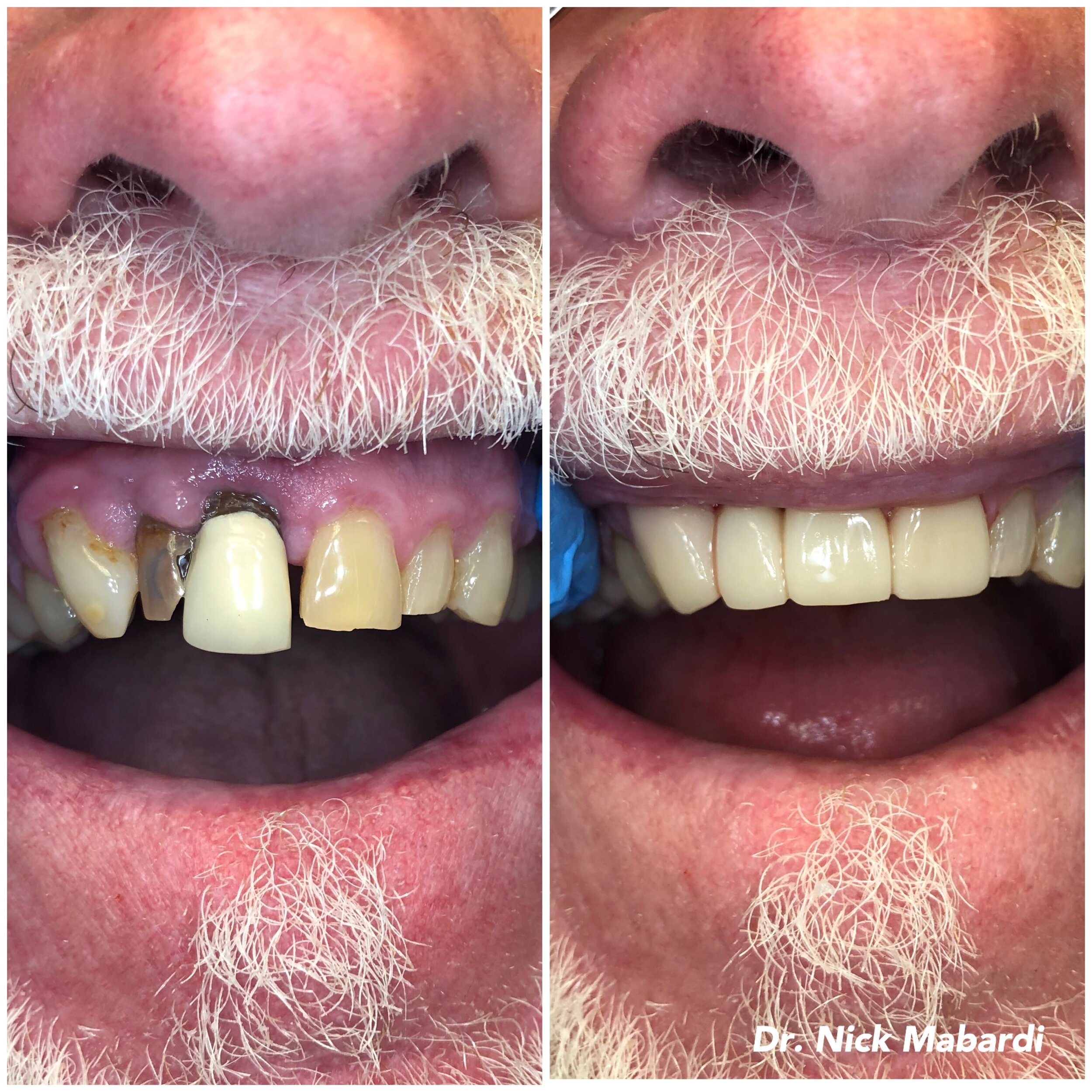 Facetune_14-05-2019-14-03-57.jpg