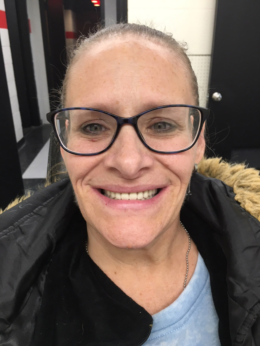 Jennifer-Neri-47-years-old-Dr-Adam-Brewer-Sept-2018-(AFTER).jpg