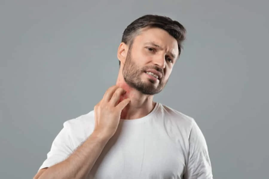 Health Talk: Exercise allergy, and more