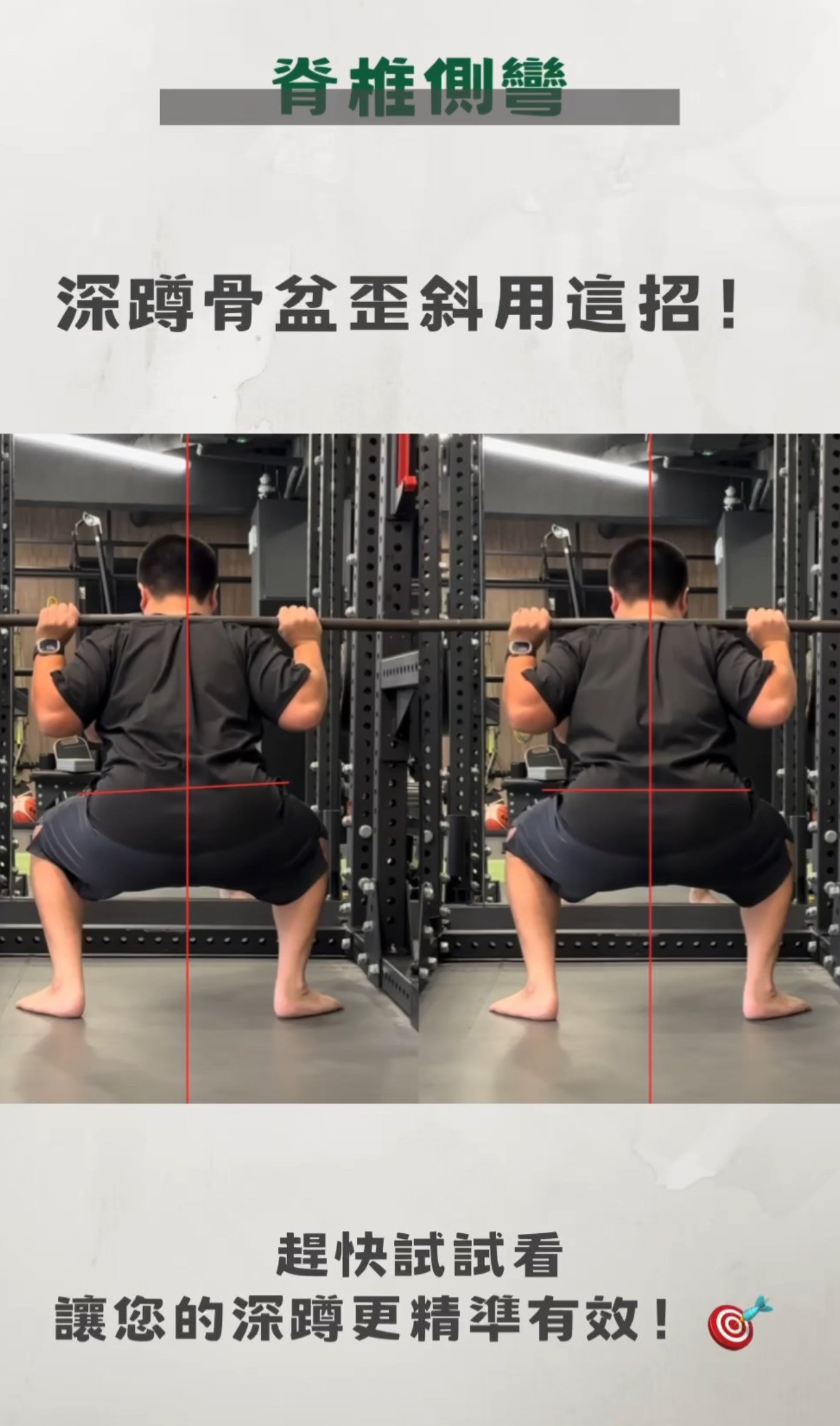 深蹲骨盆歪斜？這樣調整才能真正矯正！