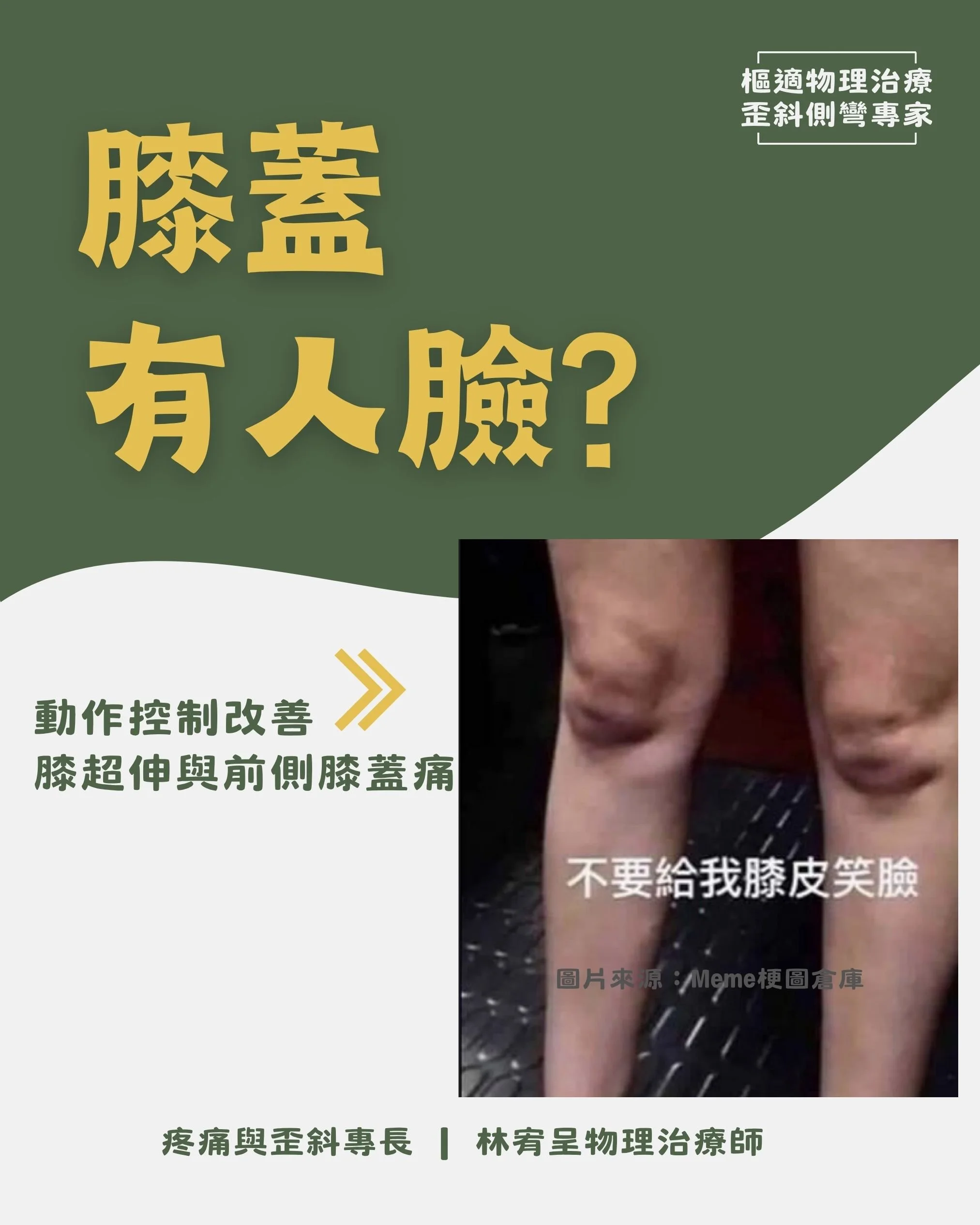 膝蓋上怎麼有張人臉？認識髕下脂肪墊、膝超伸與膝前側疼痛