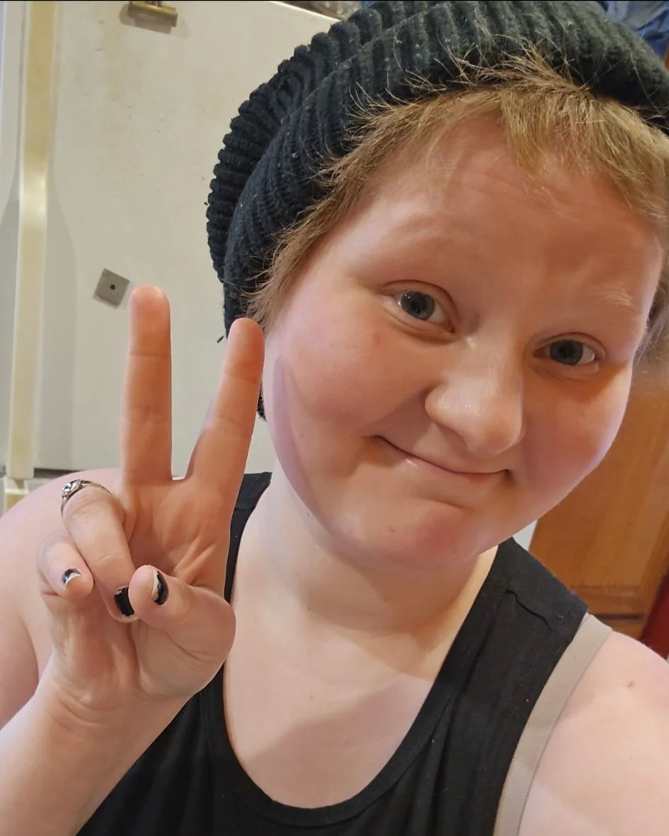 78 | Jupiter | Desmoplastic Small Round Cell Sarcoma