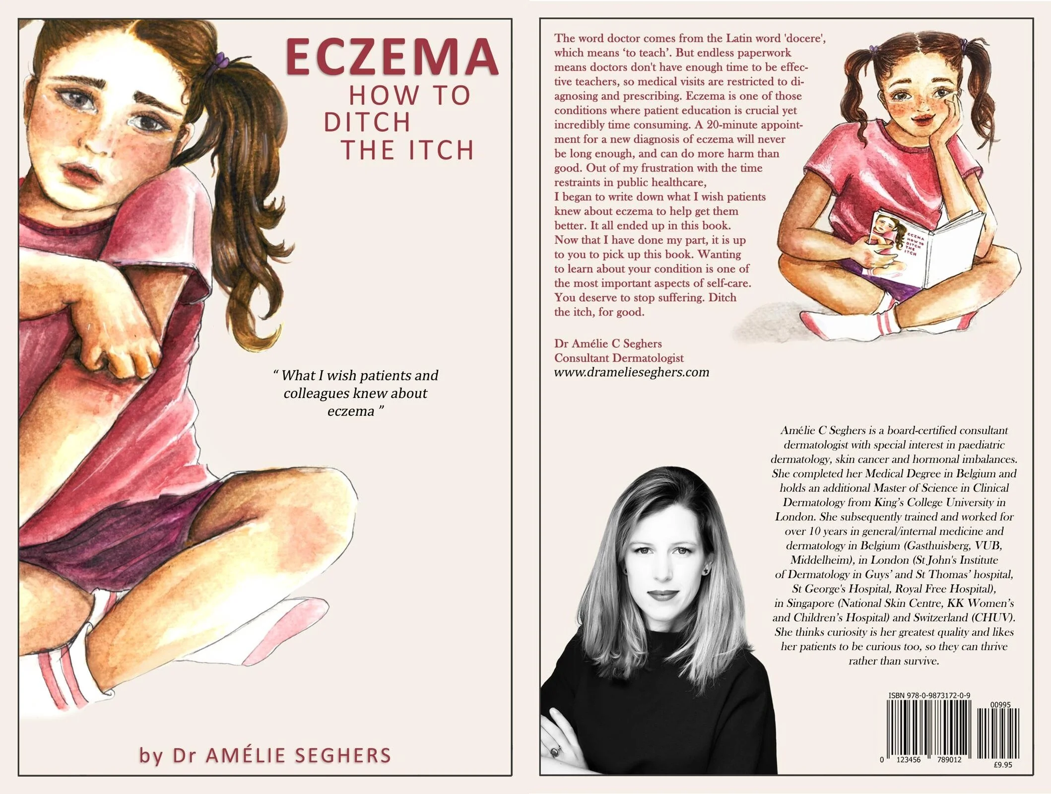 Eczema - How to Ditch the Itch by Consultant dermatologist Dr Amélie Seghers