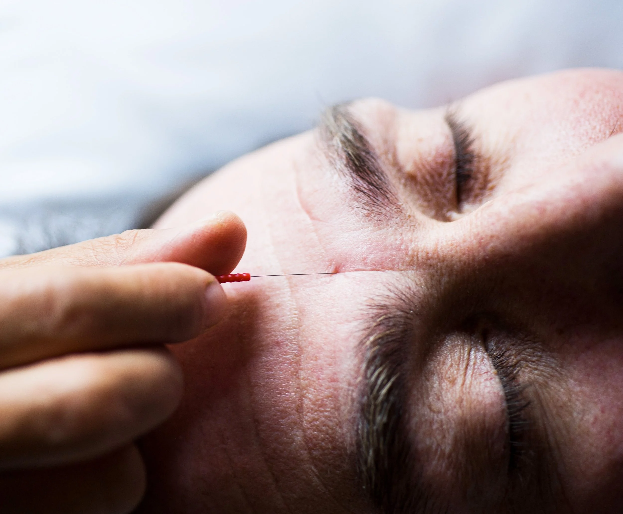 Acc Needle_3319-2.jpg