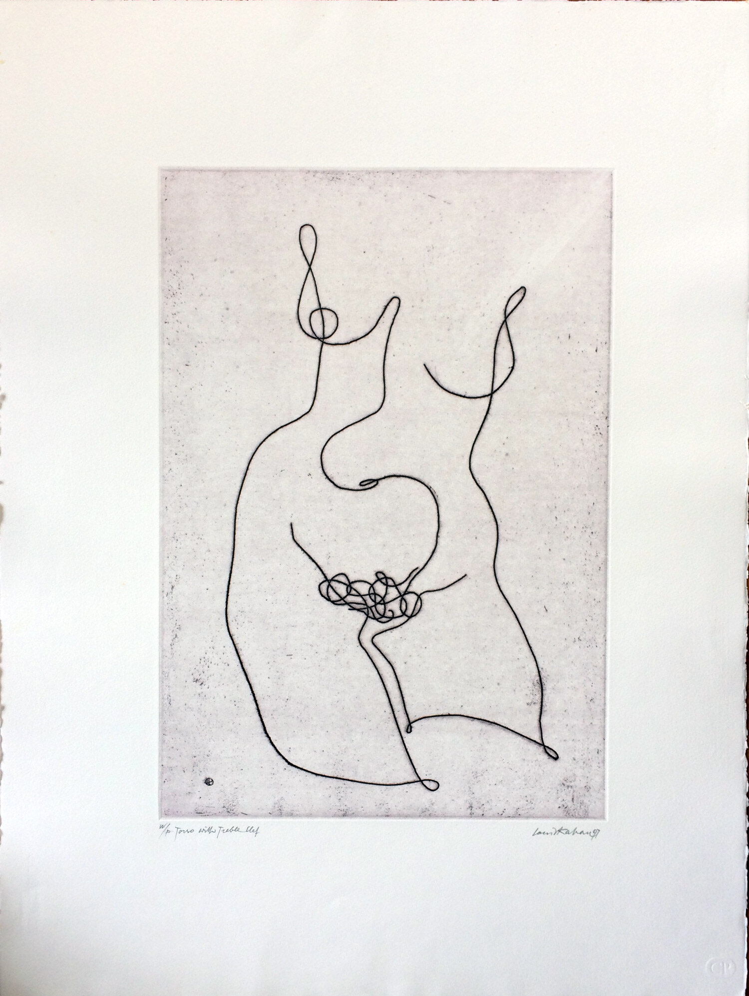 Torso with treble clef, 1997, etching