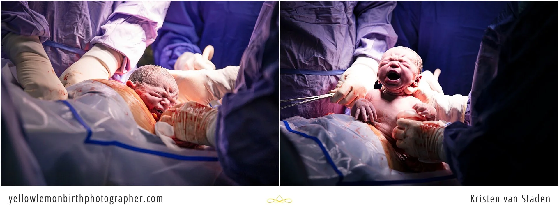 c-section birth at life vincent pallotti hospital cape town_0003.jpg