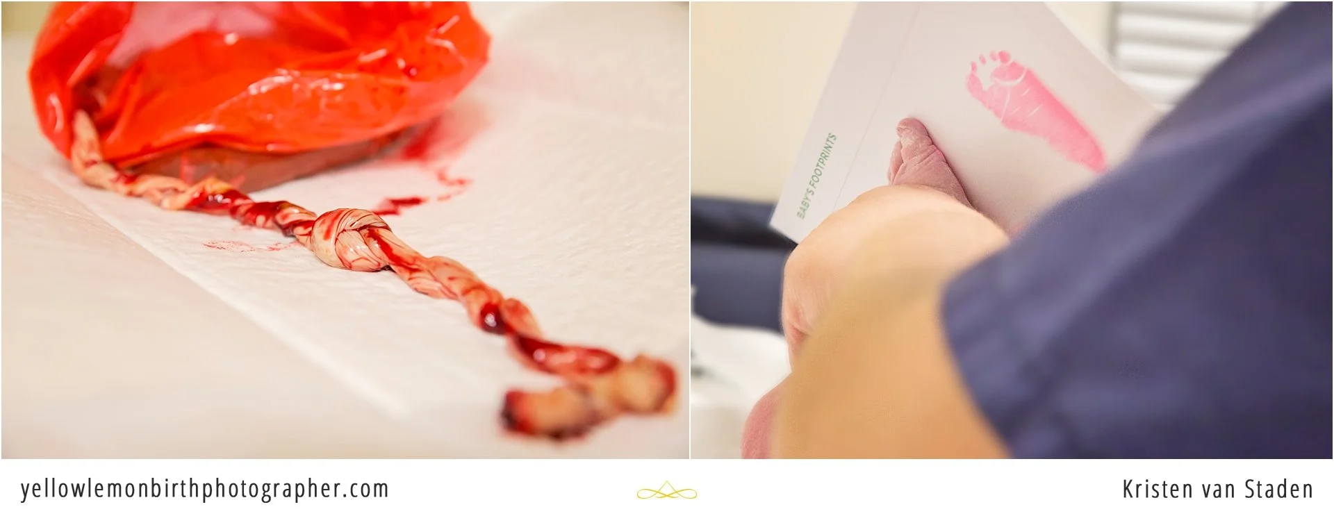 yellow lemon birth photo packages cape town_0007.jpg