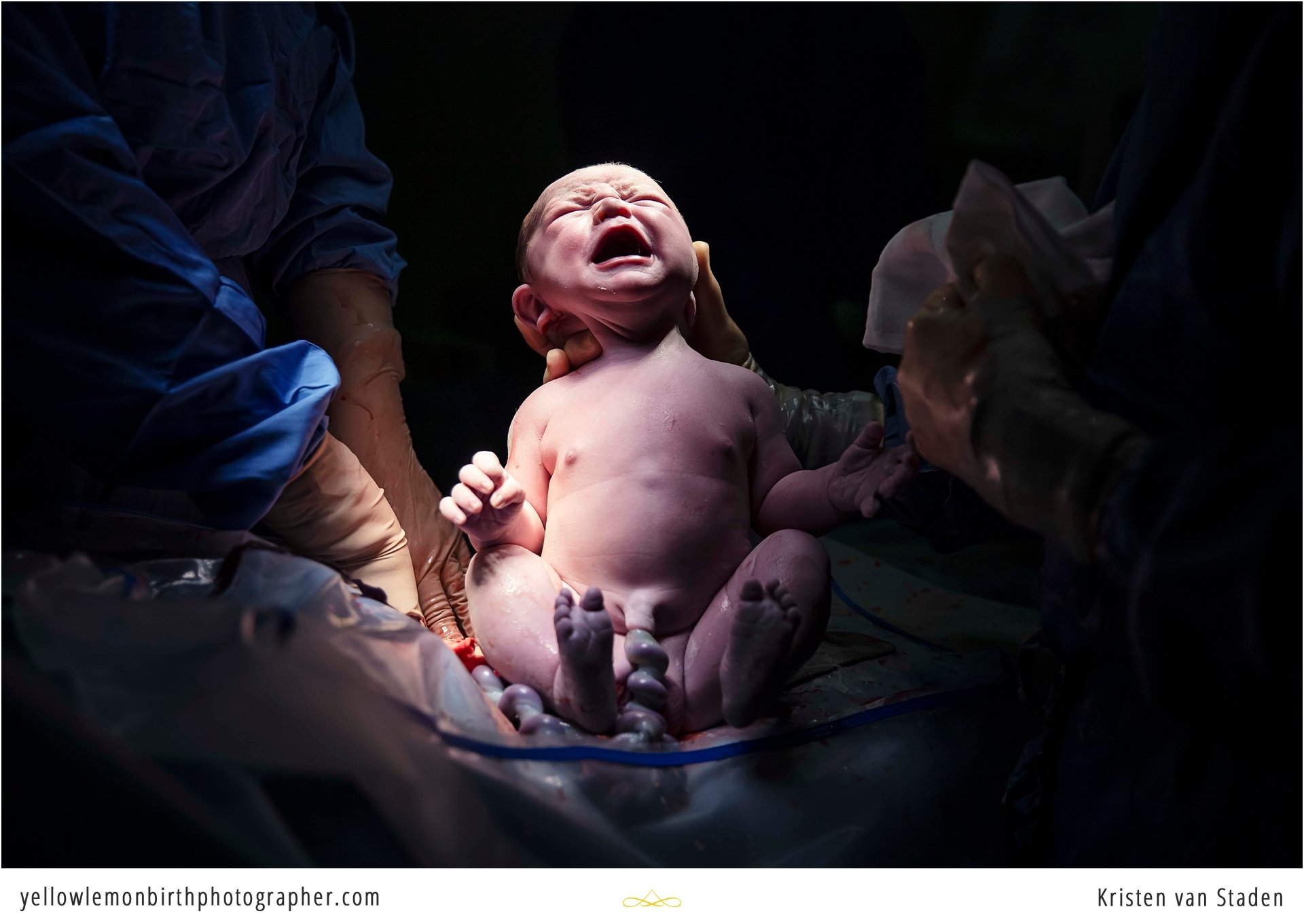 beautiful elective c-section birth cape town_0009.jpg