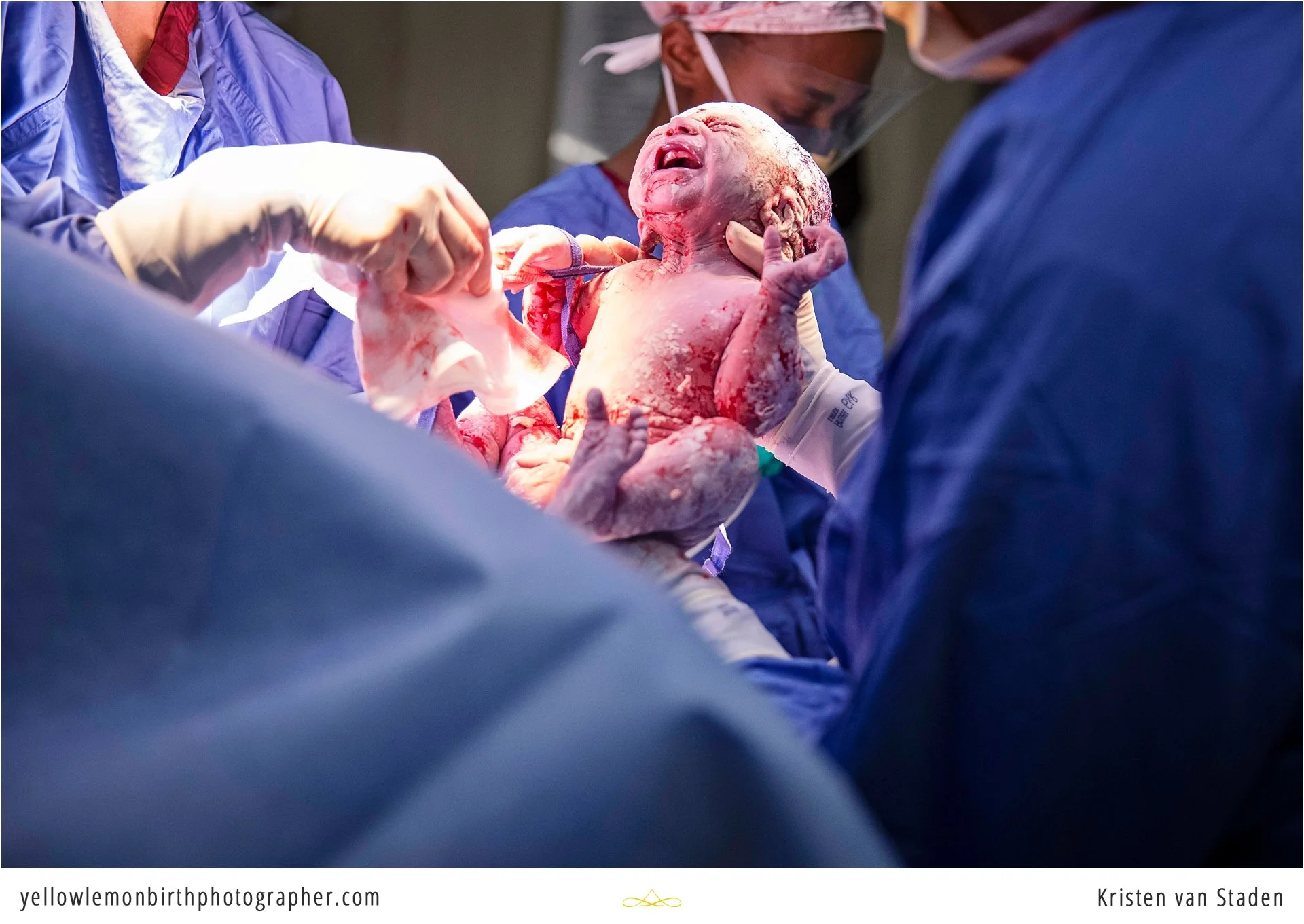 c-section birth at cape town mediclinic_0006.jpg