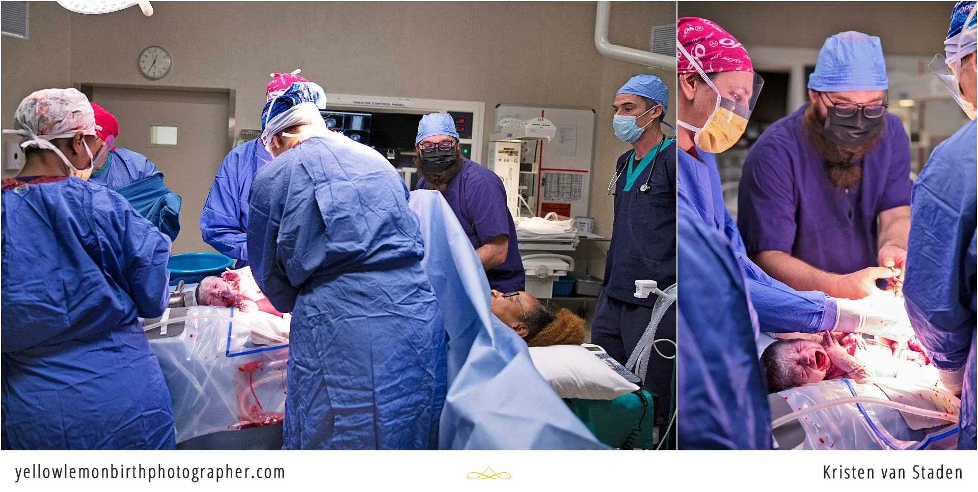 c-section birth at cape town mediclinic_0007.jpg