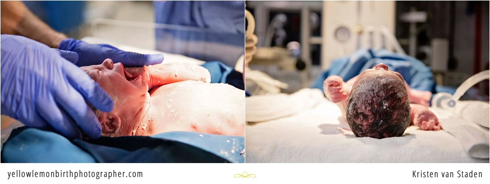 c-section birth at cape town mediclinic_0010.jpg