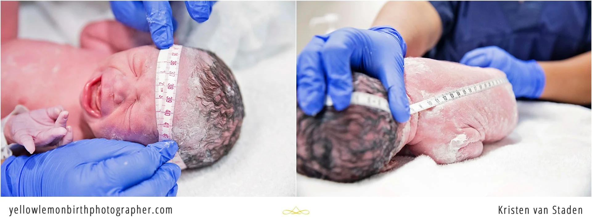 c-section birth at cape town mediclinic_0018.jpg