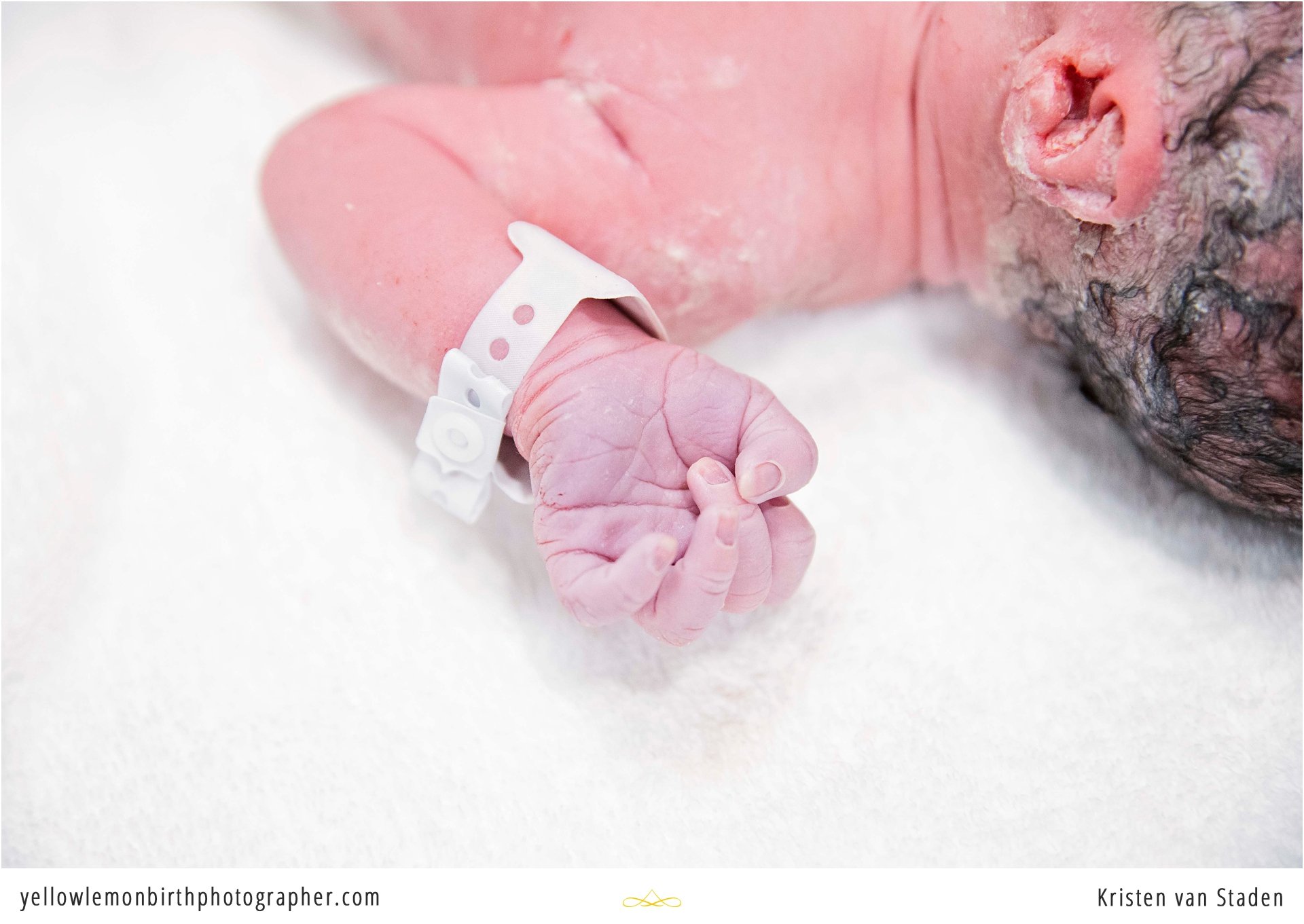 c-section birth at cape town mediclinic_0019.jpg