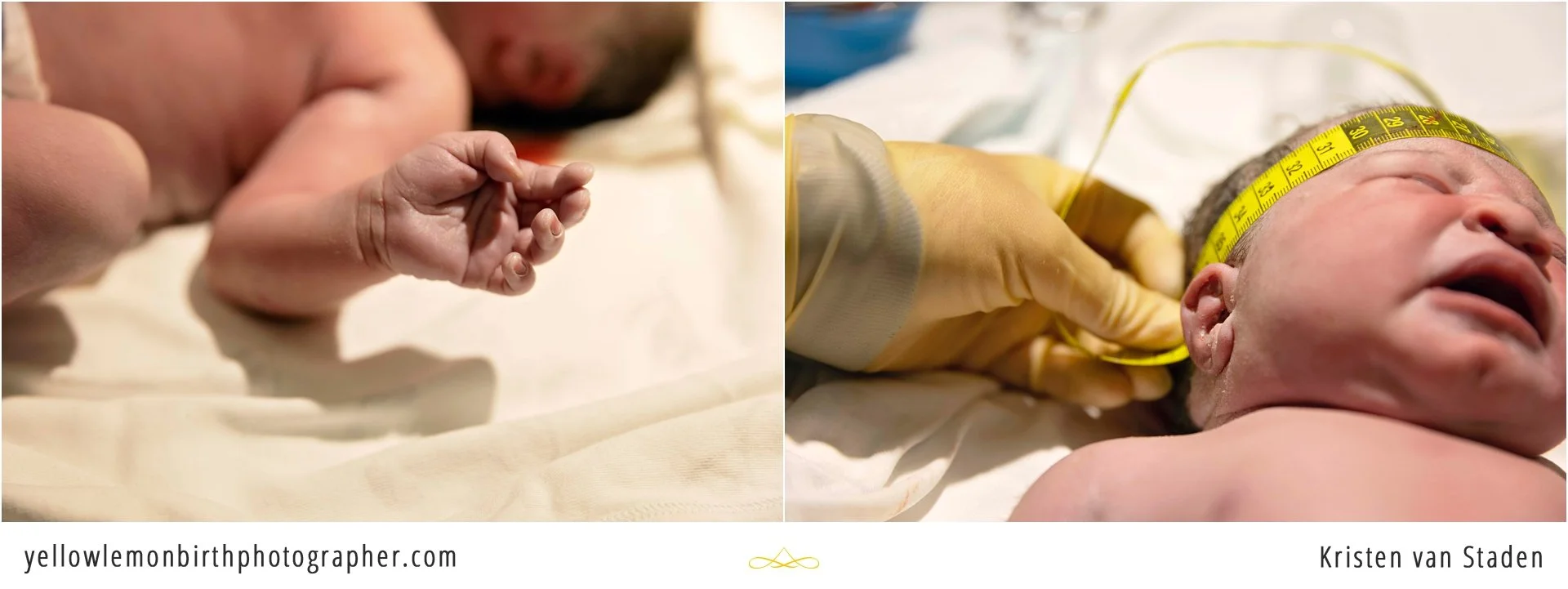 hospital c-section birth photos cape town__0010.jpg