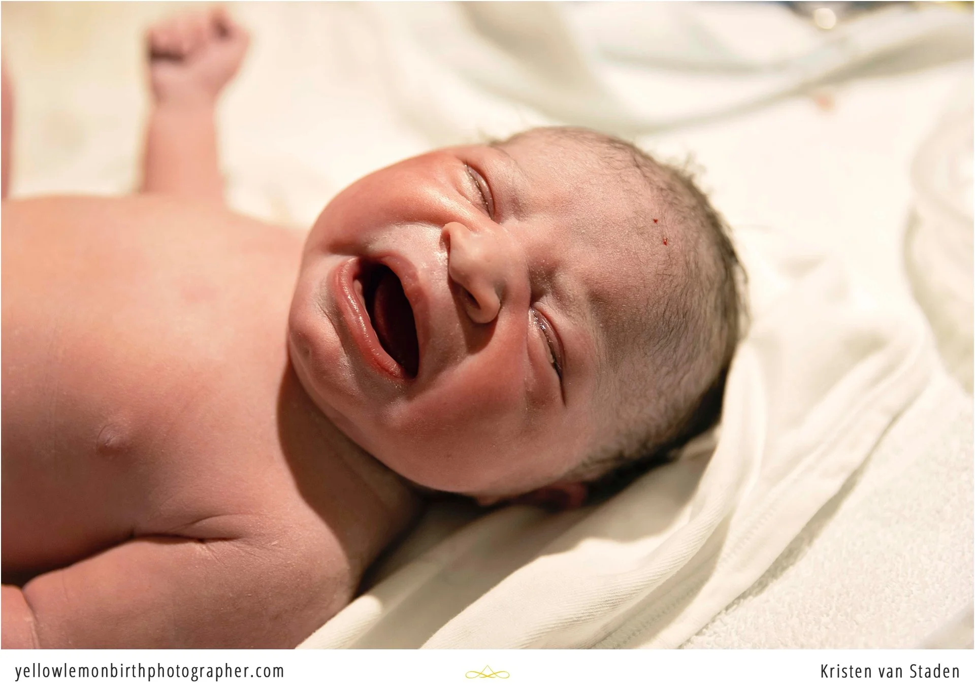 hospital c-section birth photos cape town__0011.jpg