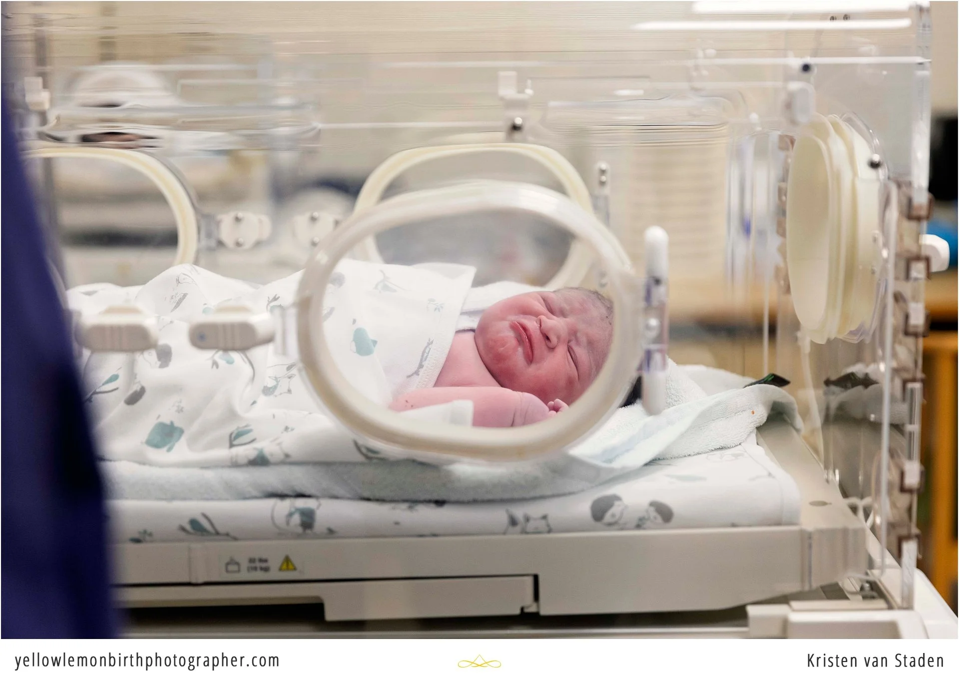 hospital c-section birth photos cape town__0014.jpg