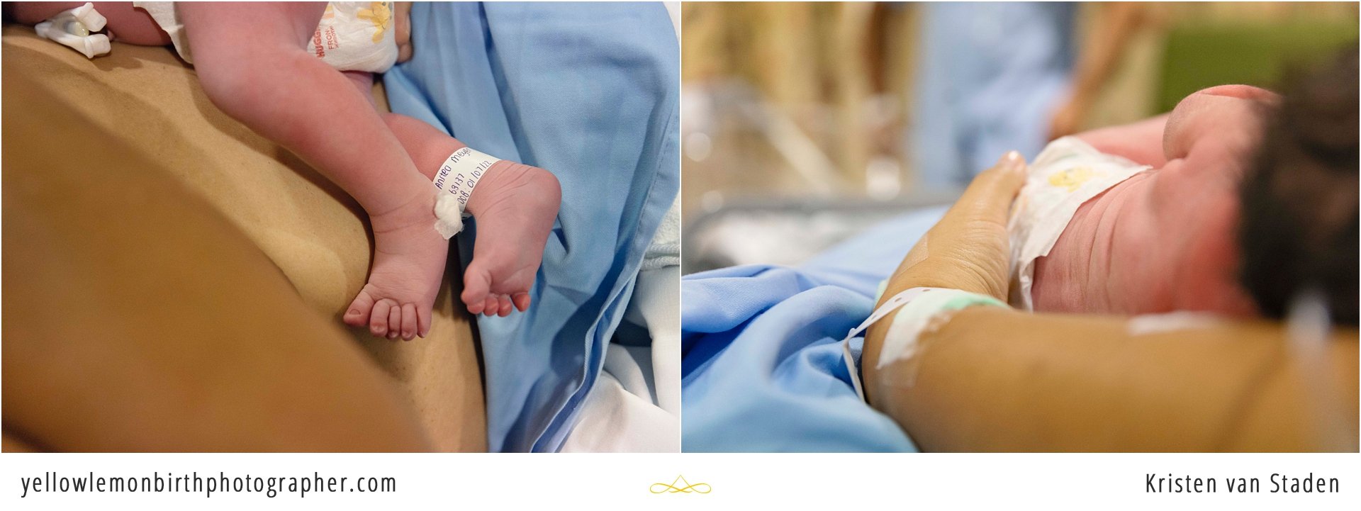 hospital c-section birth photos cape town__0020.jpg