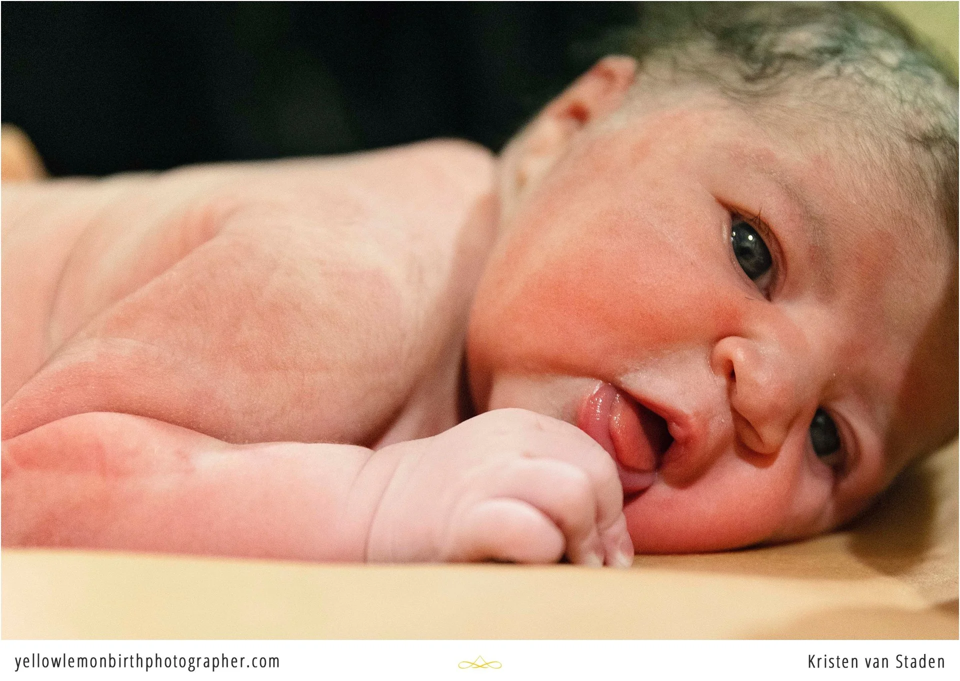 hospital c-section birth photos cape town__0022.jpg