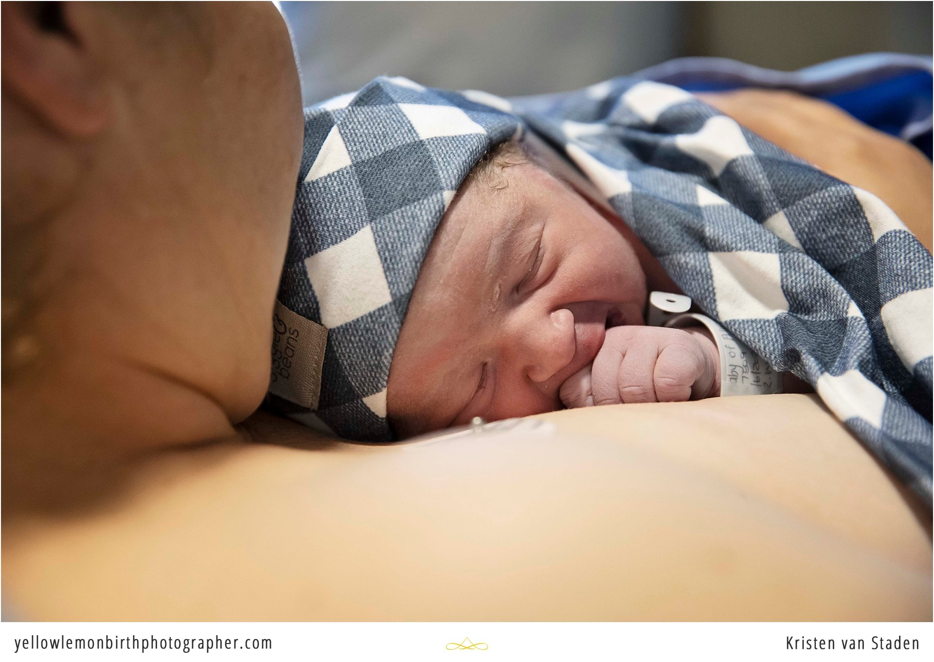 elective cesarean birth cape town_0043.jpg