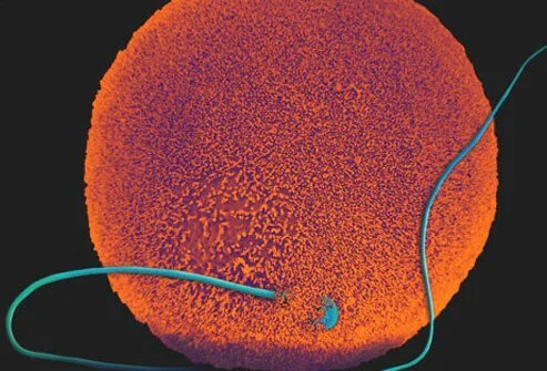 Editing the Wiktionary Entry for “Female”