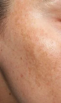 Shop - Pigmentation.JPG