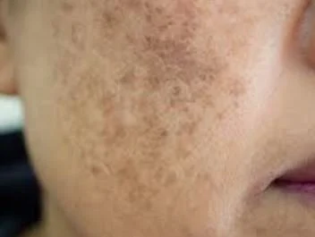 Shop Pigmentation 2.JPG