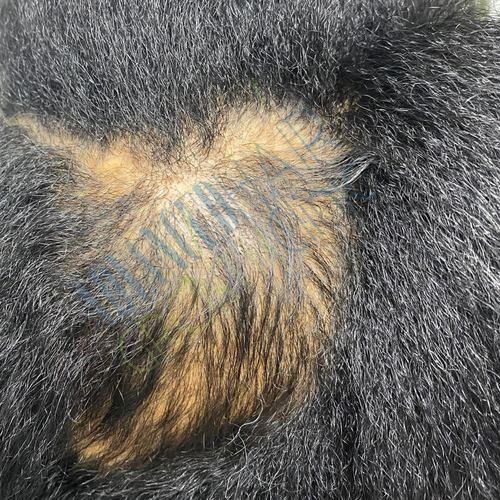Alopecia areata continued growth