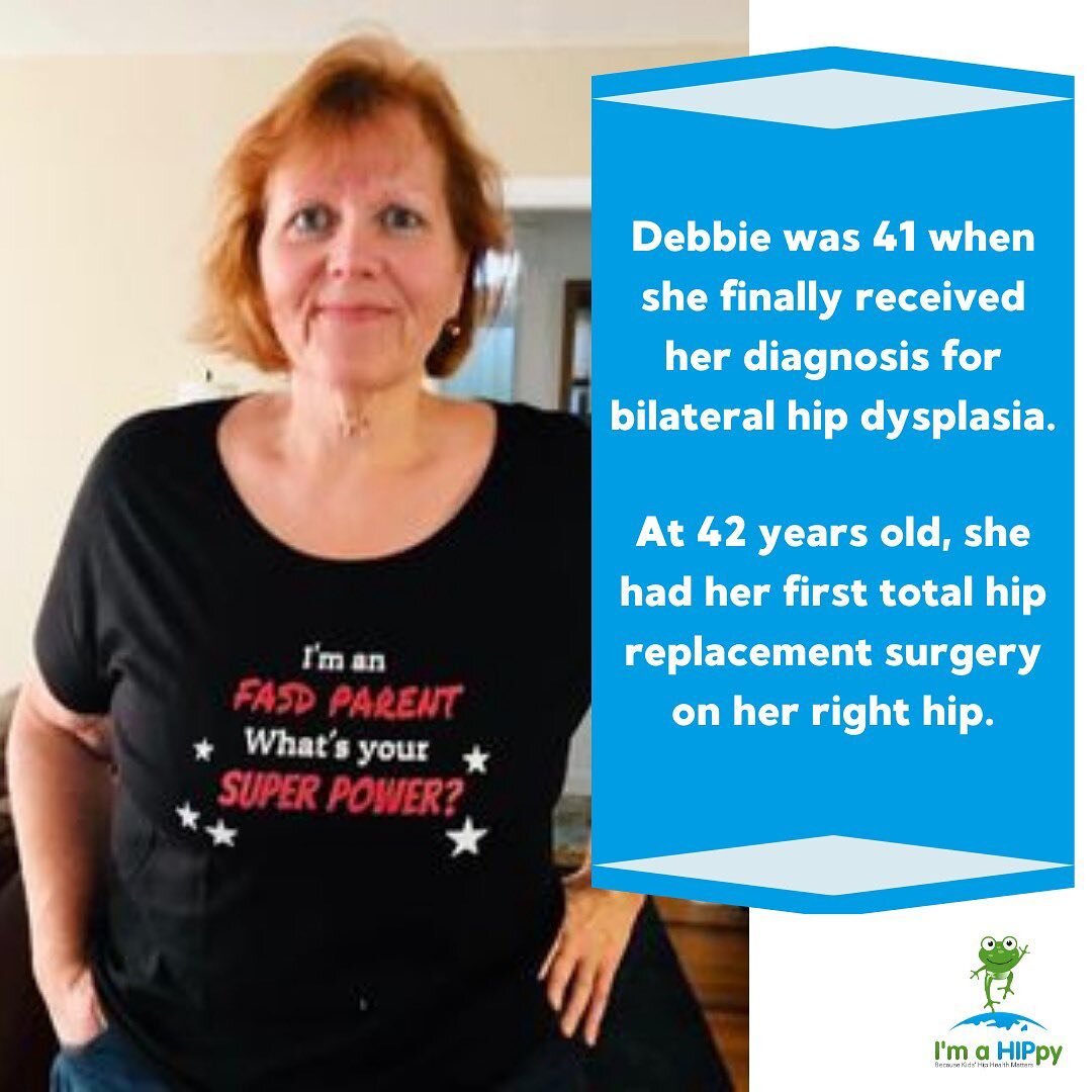 👋 Hey HIPpies, today we are excited to introduce you to Debbie @fasd_strong &ndash; a #hipdysplasiawarrior and a wonderful mother to two beautiful children.

Debbie was 41 years old when she was finally diagnosed with bilateral hip dysplasia.

She e