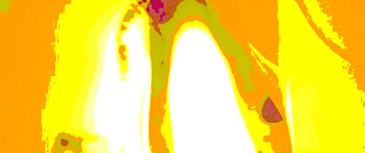 Burning Juicy