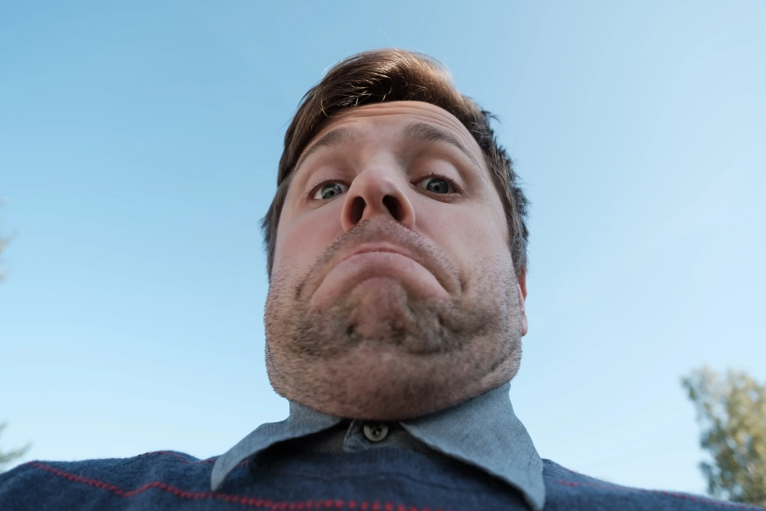 Do You Suffer From Zoom Chin?