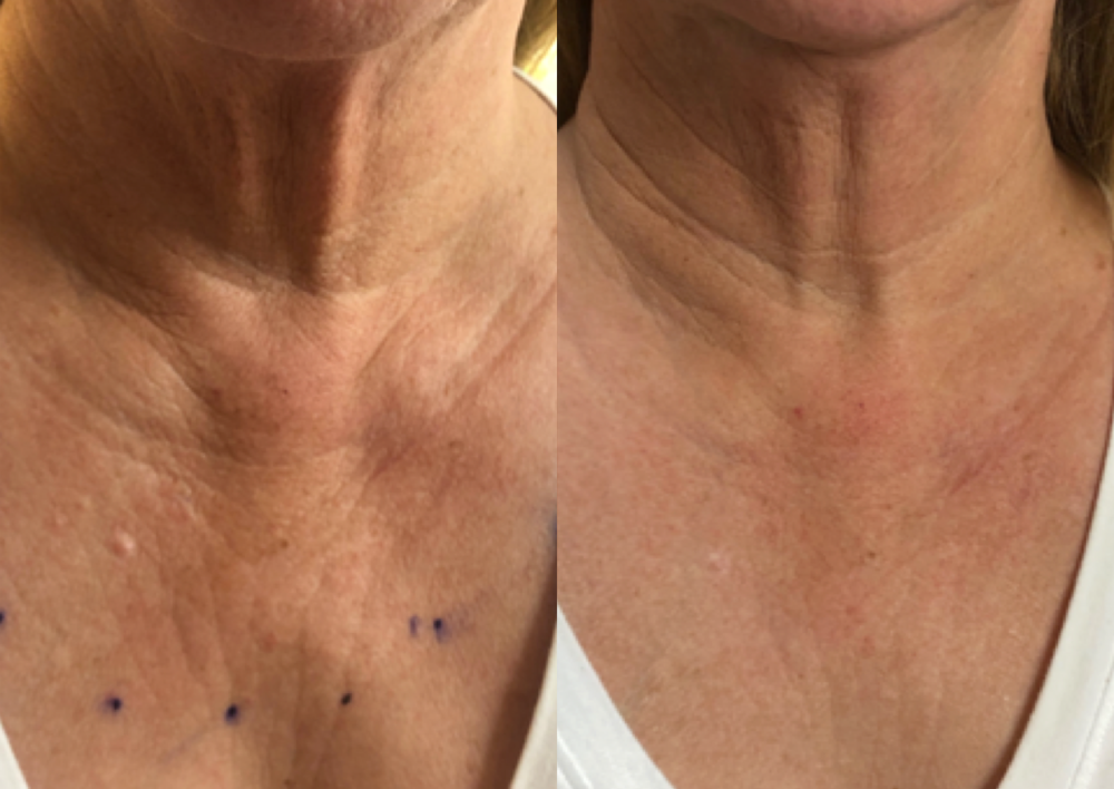 The 5 best treatments for glowing skin 2 Before+and+after+Yearly+Facial