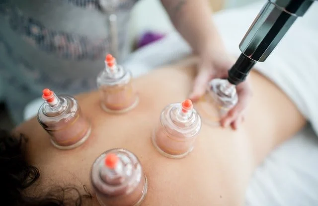 cupping therapy bend
