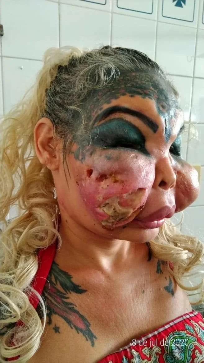 plastic surgery horror.jpeg