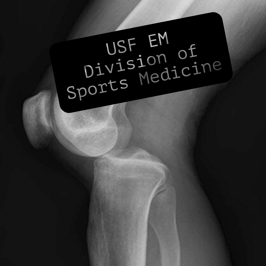 Introducing Our Sports Medicine Division