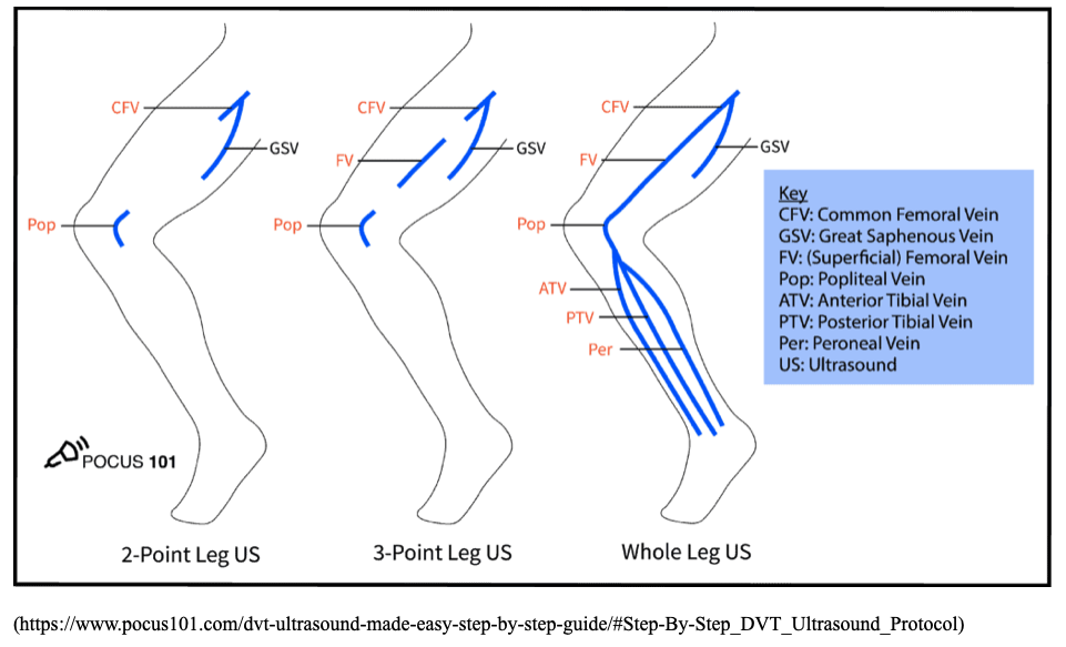 Peroneal Artery Ultrasound peroneal-artery-ultrasound
