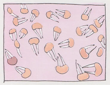 Bicuspid01.jpg
