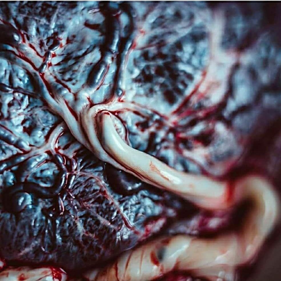 How majestic is the birthing body!
It creates this organ that grows with, protects and gives life to your baby. 💫

There is no other organ the body creates that expels after serving it's purpose. 🌱

Did you get to see your placenta after birthing y