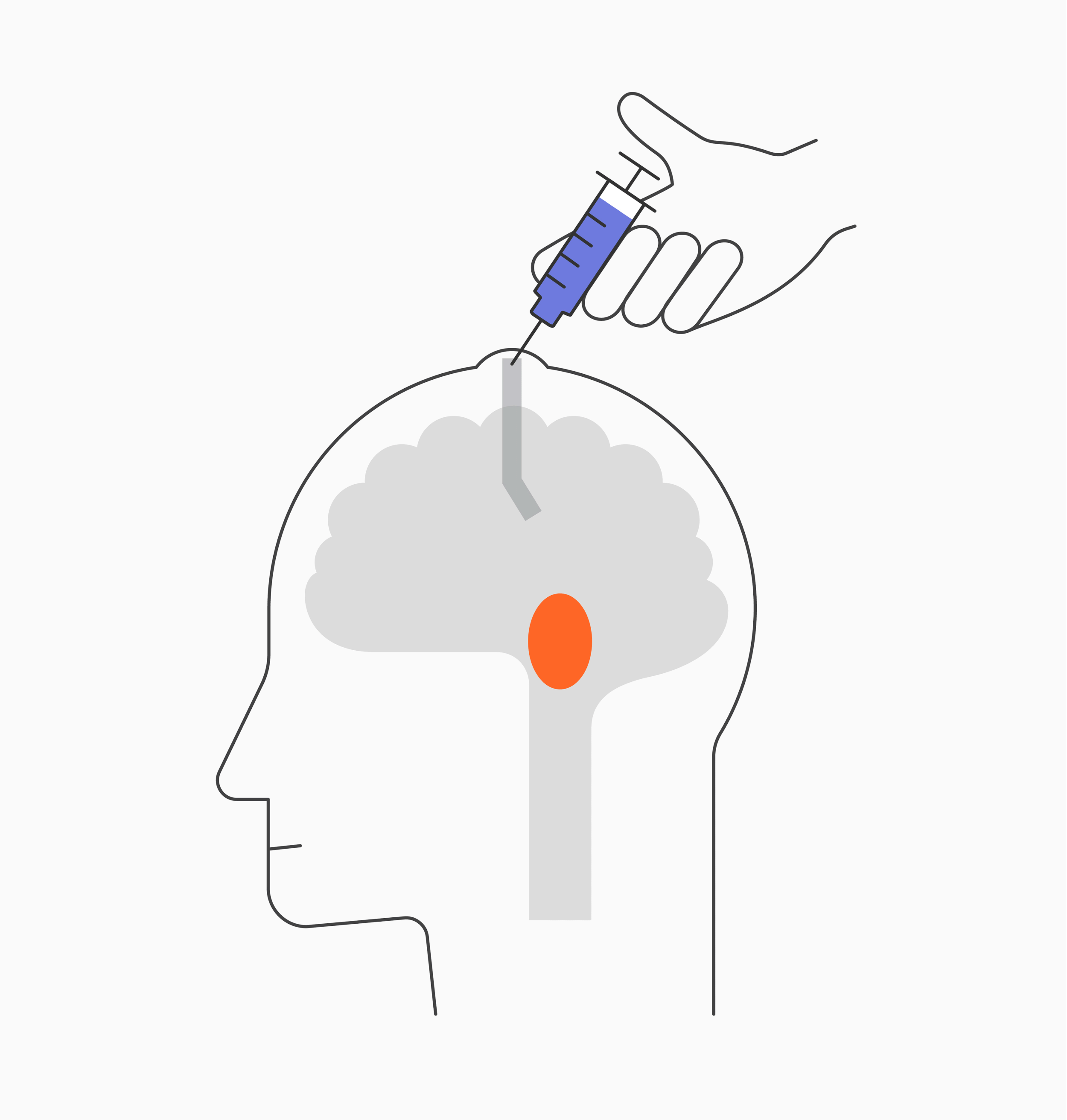 Animated diagram of the CAR-T cell therapy injection process pioneered by the Seattle biotech BrainChild Bio for tumors in the central nervous system.