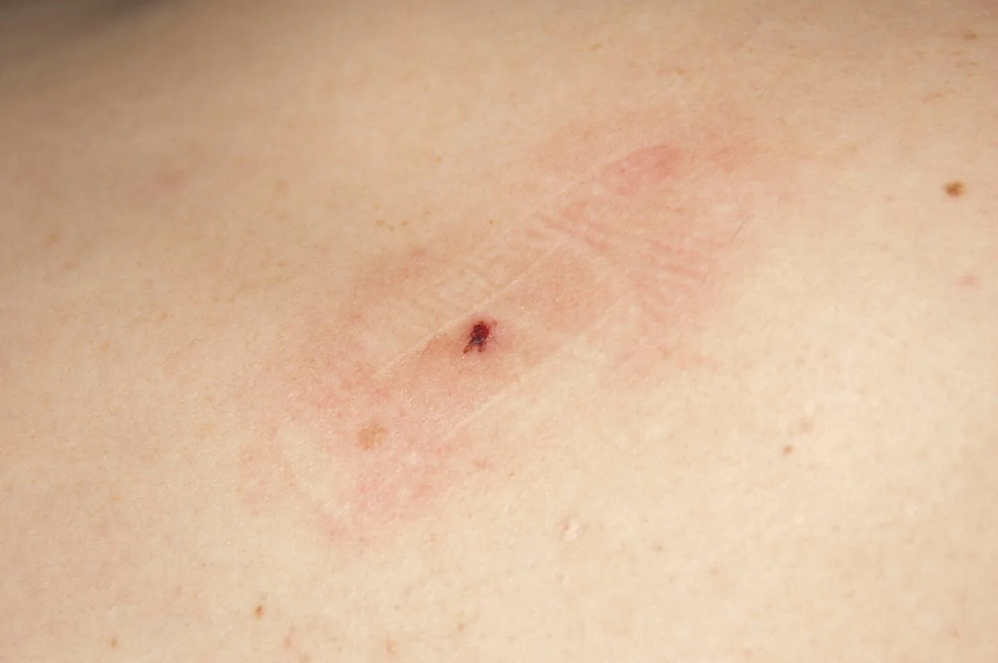 2007_ghostbandaid.jpg