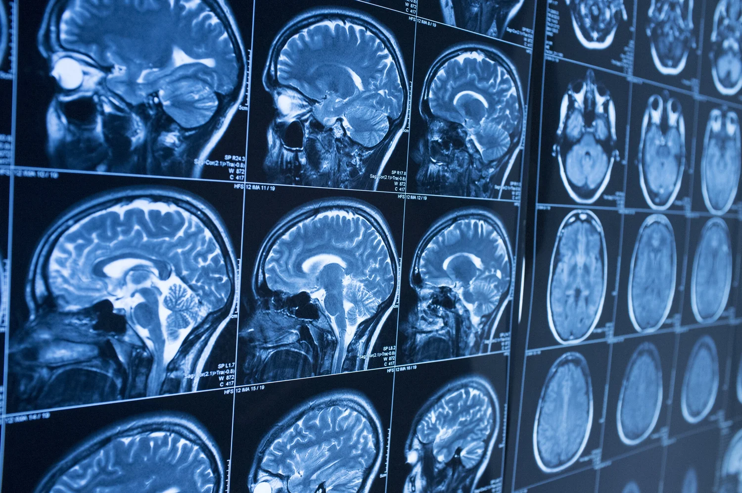 Southscan MRI