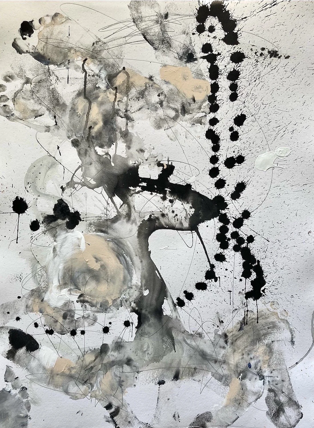 Neuroplasticity